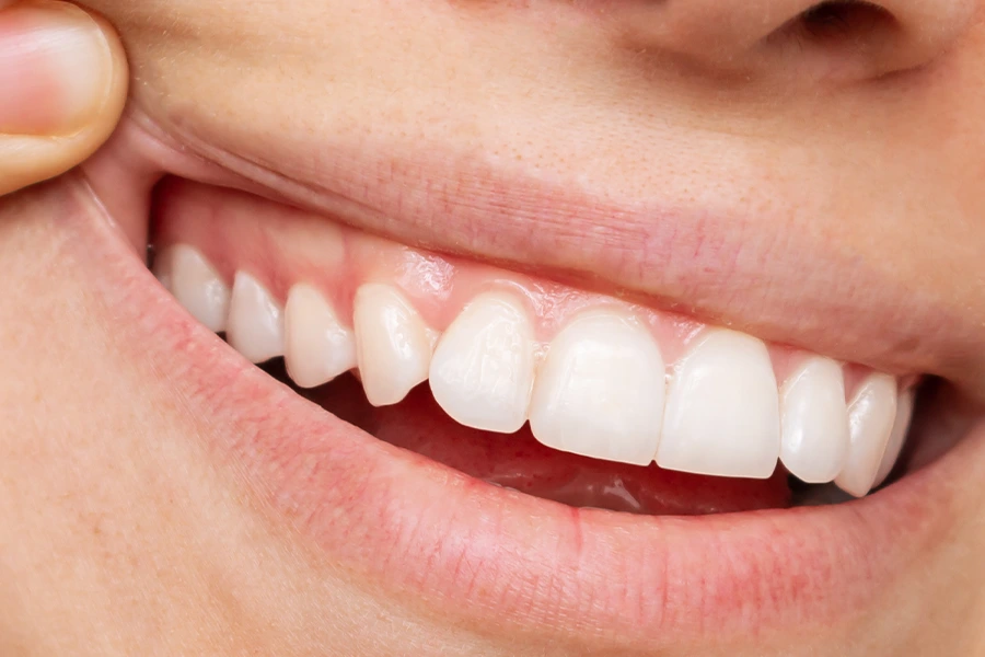 Healthy Gums Colour